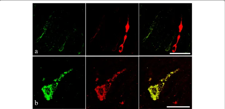 Fig. 8 a Endocrine cells from the intestinal epithelium of an acanthocephalan infected specimen of Squalius cephalus that are immunofluororeactive to the serotonin antiserum (left image) and contain a met-enkephalin-like substance (middle image)