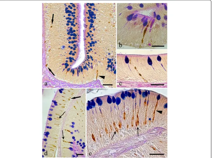 Fig. 6 Histological sections from the intestines of Squalius cephalus infected with the acanthocephalan Pomphorhynchus laevis and treated with either the galanin (a-c) or the serotonin (d-e) antisera and a subsequent AB/PAS stain for mucous cells