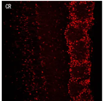 Figure  5  Calretinin-positive  periglomerular  cells.  Coronal  section of the mouse olfactory bulb with CR-positive cells in  red.