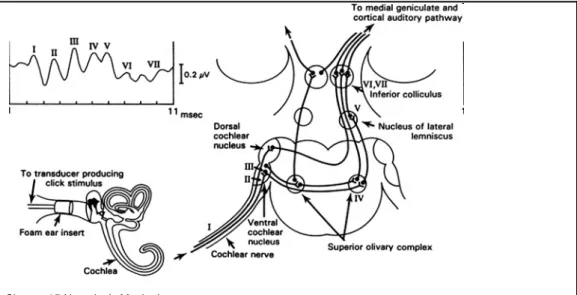 Fig. 7: Risposta elettrofisiologica (ABR) in seguito allo stimolo click.  ( Black S, Mahla ME, Cucchiara  RF, 1994)