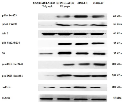 Figure 1: Expression and phosphorylation status of Akt, mTOR and the S6 downstream target in primary (unstimulated  and stimulated) CD4 +  T lymphocytes and T-ALL cell lines