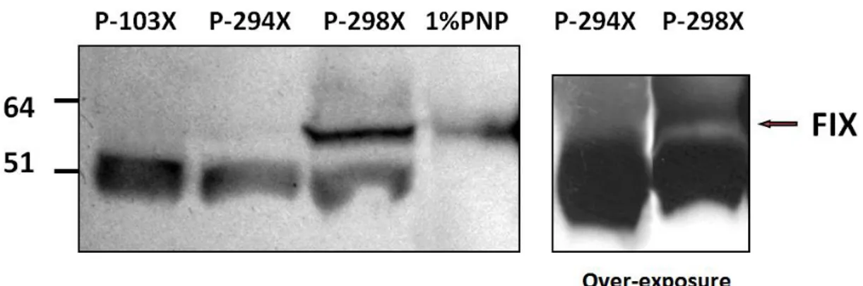 Figure 18: Western blotting of patients' plasma; left  panel 1 h exposure, right over-night exposure