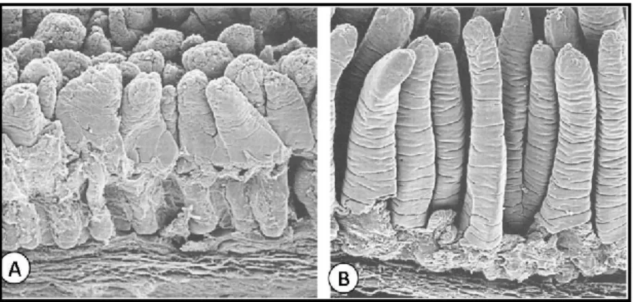 Figure  11 .  (A)  Electron  microscopy  image  of  calf  small  intestine  infected  by  Rotavirus