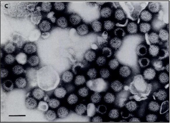 Figure  1.  Particles  observed  by  electronmicroscopy  in  filtrates  made  from  a  stool  of  a  child  with 