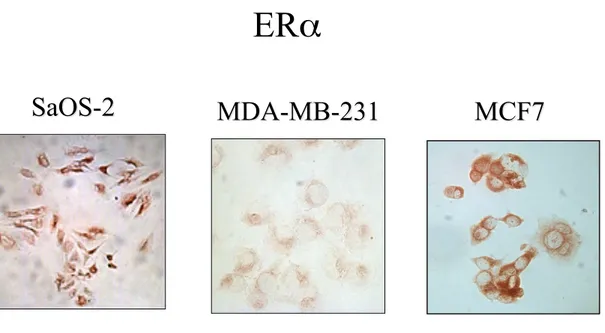 Figura 8. Analisi immunocitochimica dell’espressione di ER! in cellule SaOS-2 MDA-MB-231 e