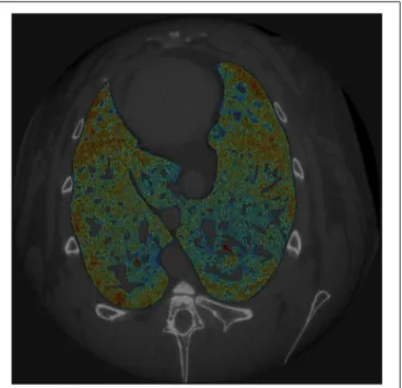 FIGURE 1 | Example of SRCT image. For each animal, 40 sequential SRCT images were obtained from the central part of the lungs