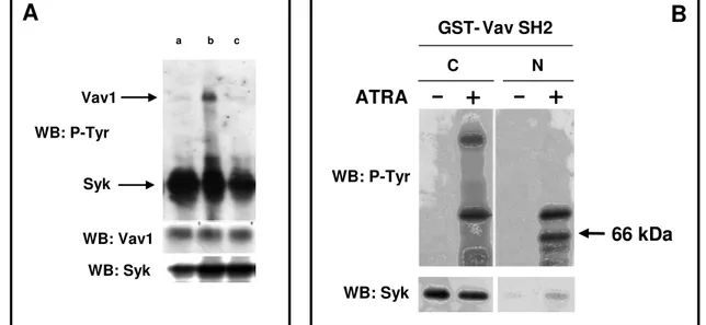 Figura 10. In A, saggio di attività Syk-chinasica in vitro che dimostra come in cellule HL-60 differenzianti  Syk  fosforili  Vav1  (a:  controllo;  b:  ATRA;  c:  ATRA+Picetannolo)