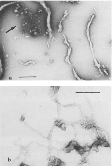 Foto  2.  Micrografia  elettronica  dei  complessi  protamina:actina  G a bassa concentrazione ionica
