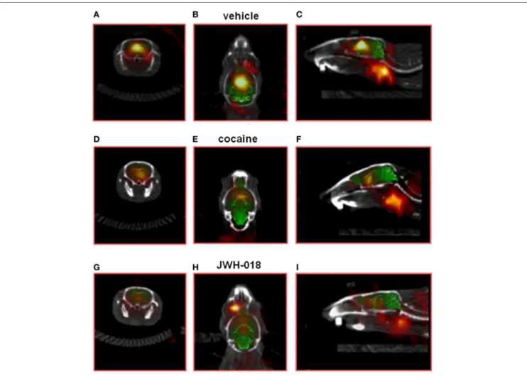 FigUre 2 | Sample slice from a [ 123 I]-FP-CIT SPECT/CT image of a vehicle [ (a–c); respectively, coronal, transverse, and sagittal plan], cocaine [(D–F); respectively, 