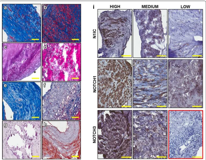 Fig. 1  Representative images of histological characteristic of patients’ plaque material
