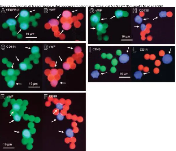 Figura 7. Caratterizzazione immunofenotipica delle CEC isolate con metodica immunomagnetica nei pazienti affetti da MM con delezione del 13q14