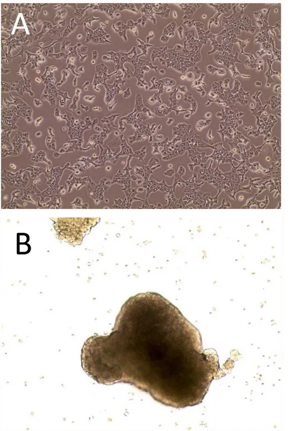 Fig 1. Morphology of cultures of the SK-ChA-1 cell line. Panel A, appearance of the adherent bidimensional culture and, Panel B, appearance of the MCTS (Multicellular Tumor Spheroids)