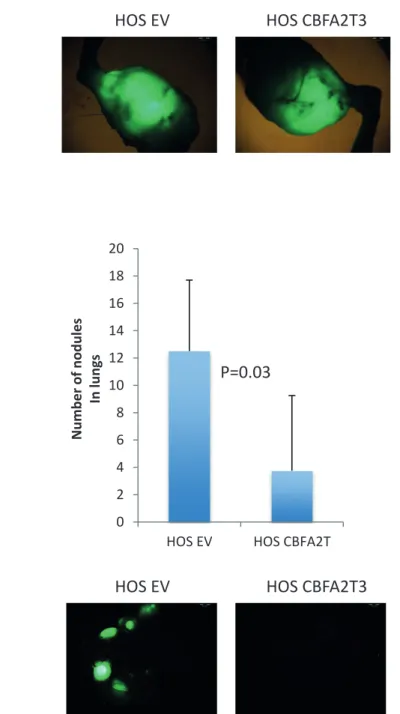 Figure 10: Effect of CBFA2T3 overexpression in HOS cells on primary tumors and lung metastases