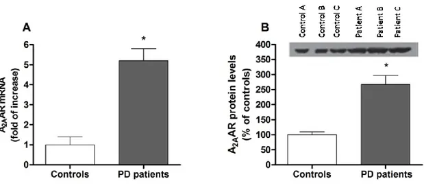 Fig.  2R-  A 2A AR  mRNA  (A)  and  protein  (B)  levels  in  putamen  tissues  of  control  and  PD 
