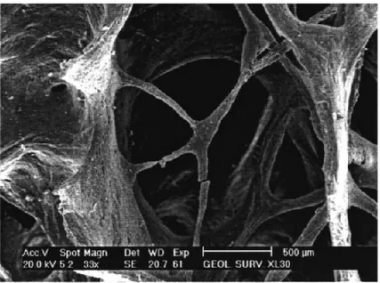 Figura 8. Microscopio elettronico a scansione di una porzione di osso trabecolare che  mostra la perforazione di una sottile trabecula orizzontale (Zaki et al., 2009) 