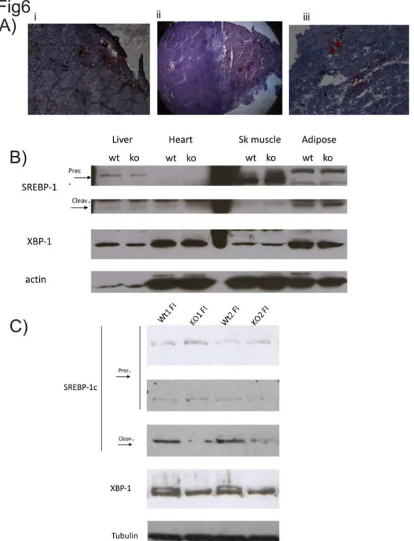Fig. 6: Freeze-injury and glycerol injection induce intramuscular adipocytes accumulation