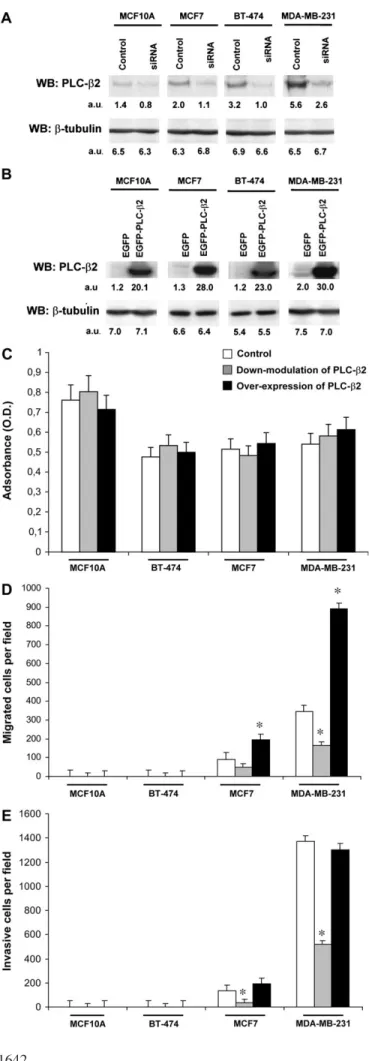Fig. 2. PLC-b2 is involved in migration and invasiveness of breast cancer- cancer-derived cell lines