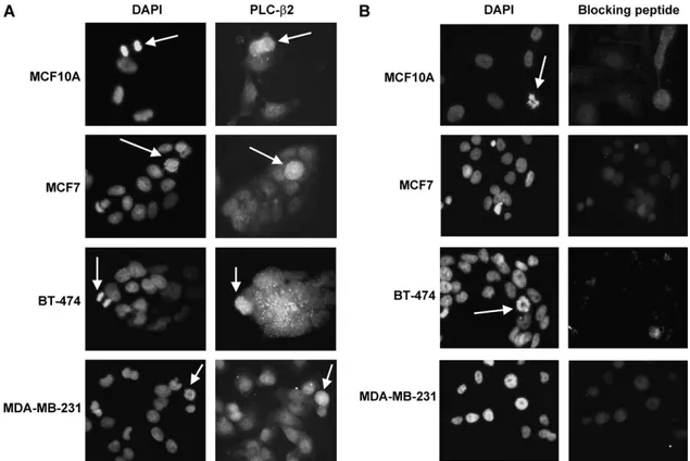 Fig. 3. PLC-b2 expression is highest in the late mitotic stages. Immunocytochemical analysis of PLC-b2 expression was performed on non-transformed and tumoral breast-derived cell lines (A)