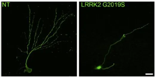 Fig. 9. Defects in neurite outgrowth in neurons from LRRK2-G2019S mice (Winner et al., 2011)