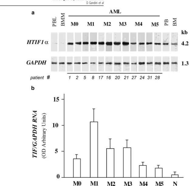 Figure 2 HTIF1 ␣ gene expression in AML patients. (a) Northern blot of HTIF1␣ RNA in BM samples from AML patients