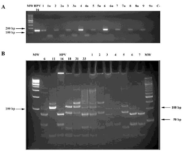 Figura 6. PCR di campioni positivi e negativi per HPV (A) e genotipizzazione del virus (B)