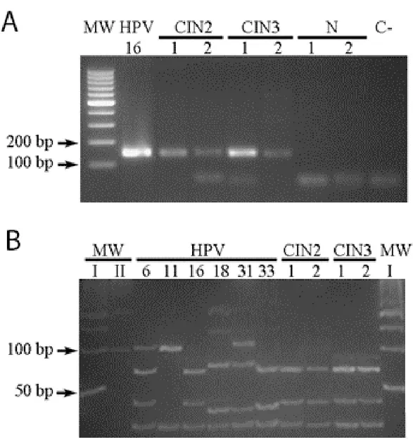Figure 5. HPV PCR and HPV genotyping. A: the agarose gel shows HPV PCR results  