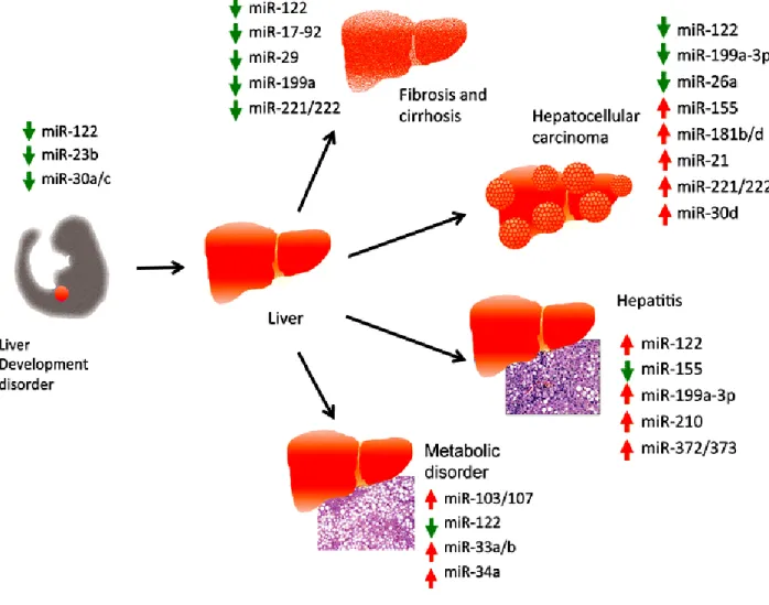 Figure 1.6:  Summary of deregulated miRNAs identified in different liver disease.  The  arrow indicates  the abnormal expression pattern of each miRNA in the designated disease