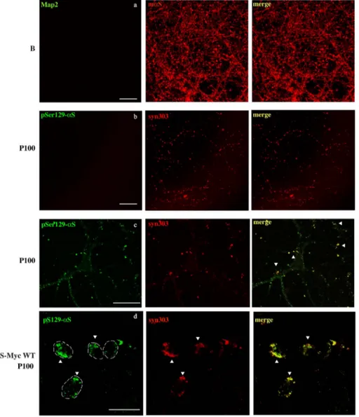 Fig. 3. Internalization and spreading of P100 fractions into neuronal cultures.