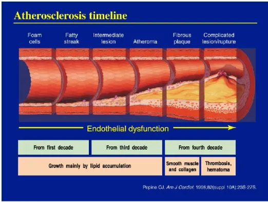 Figure 7. Atherosclerosis progression. 