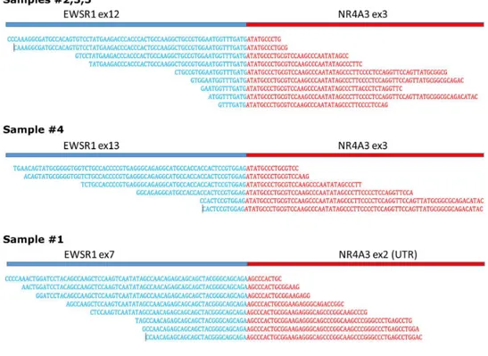 Figure  1.  Three  different  EWSR1-NR4A3  breakpoints  identified  through  whole  transcriptome  sequencing (WTS)