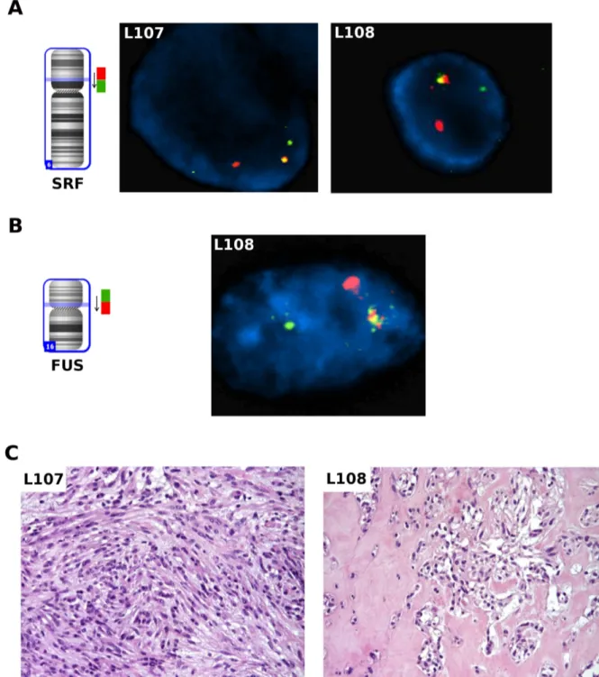 Figure 3: FISH analysis on thawed frozen tumor specimens.  A. FISH analysis for the SRF gene on thawed frozen tumor 