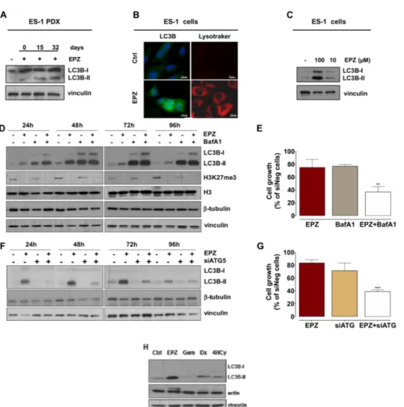 Figure 4. EPZ-011989 induces autophagy in ES-1 PDX and derived cell line. (A) Western blot analysis of LC3B in tumors obtained from untreated and EPZ-011989-treated mice at different intervals from the end of treatment