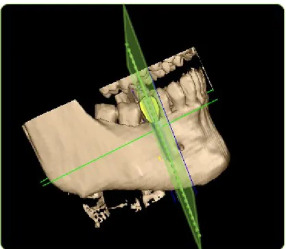 Fig. 4.3.  Cross-sectional plane parallel to the axis of interest 