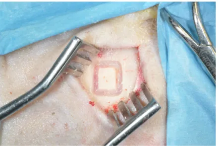 Figure  10:  rectangular   antrostomy   performed   with  surgical bur to access the maxillary sinus