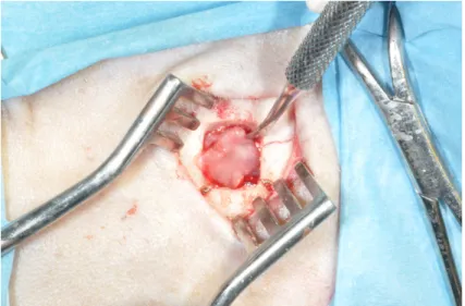 Figure  12:  Schneiderian   membrane   was   elevated.  Sinus   was   grafted   with   biomaterial   and   non   woven  scaffold with ADPSc.