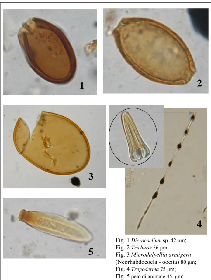 Fig. 3 Microdalyellia armigera   (Neorhabdocoela - oocita)  80 μm ;  Fig. 4  Trogoderma 75 μm ; 