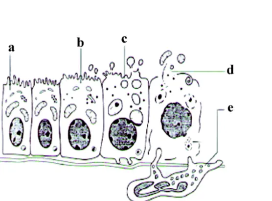 Figura 8: Fasi del processo necrotico. a) cellula normale; b) modificazioni reversibili;  c) punto di non ritorno; d) rottura della membrana cellulare e dispersione degli organuli; 