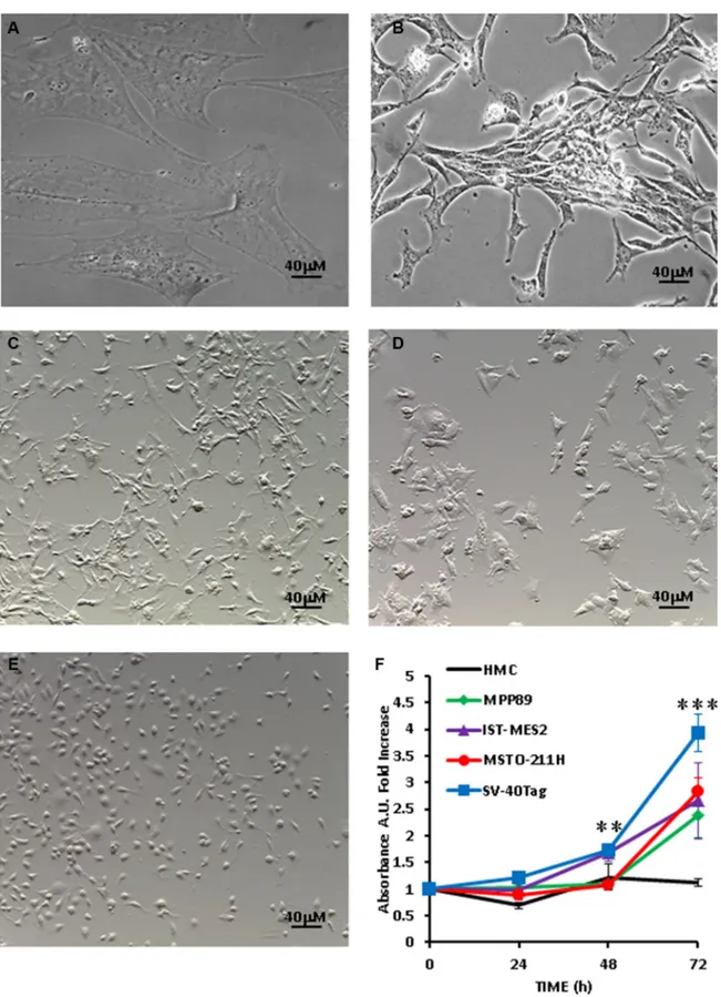 Figure 3: Growth rate and morphology of MPM cells.  (A) HMCs; (b) SV40-Tag cells; (c) MPP89 cells; (d) MSTO-211H cells;  (E) IST-MES2 cells