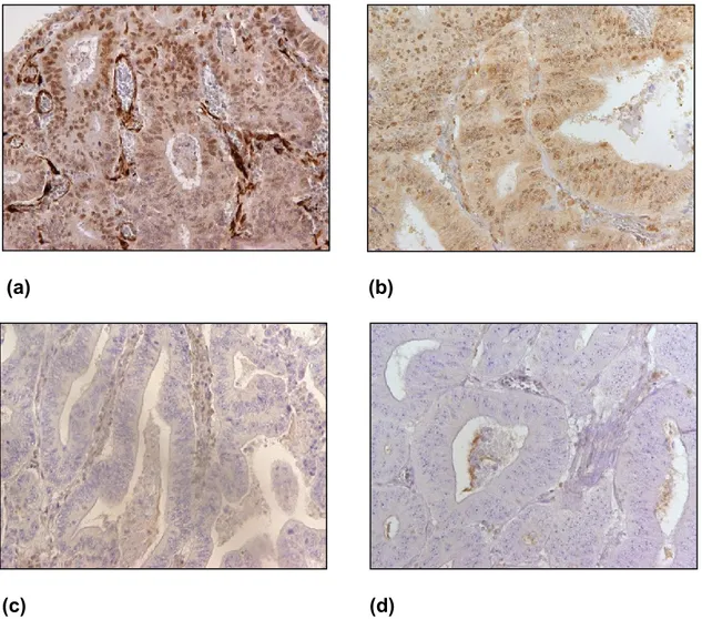Figure  8:  Immunohistochemical  staining  results  of  MSH2,  MSH6,  MLH1  and 