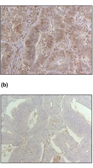 Figure  9:  Immunohistochemical  staining  results  of  MSH2,  MSH6,  MLH1  and 