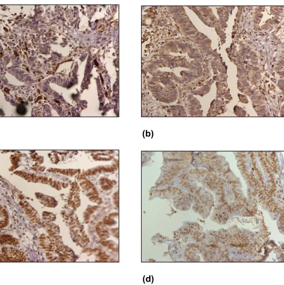 Figure  10:  Immunohistochemical  staining  results  of  MSH2,  MSH6,  MLH1  and 