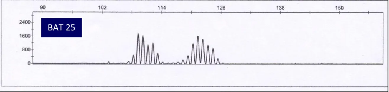 Figure 11: Electropherograms for BAT25 and BAT26 from CRC tissue. (a) BAT 25 