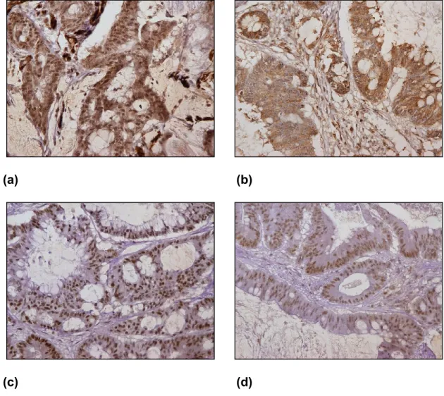 Figure  14:  Immunohistochemical  staining  results  of  MSH2,  MSH6,  MLH1  and 