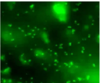 Figura  7:  Biodistribuzione  delle  nanoparticelle  T1-fluo  al  microscopio  a  fluorescenza  nel  muscolo  scheletrico  e  cardiaco  dei  topi  mdx