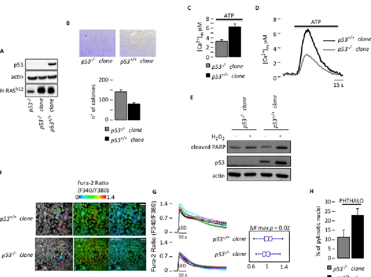 Figure 1: Defective Ca 2+  homeostasis and apoptosis due to a lack of p53.  (A) Generation of H-RAS v12 -transduced  MEF 