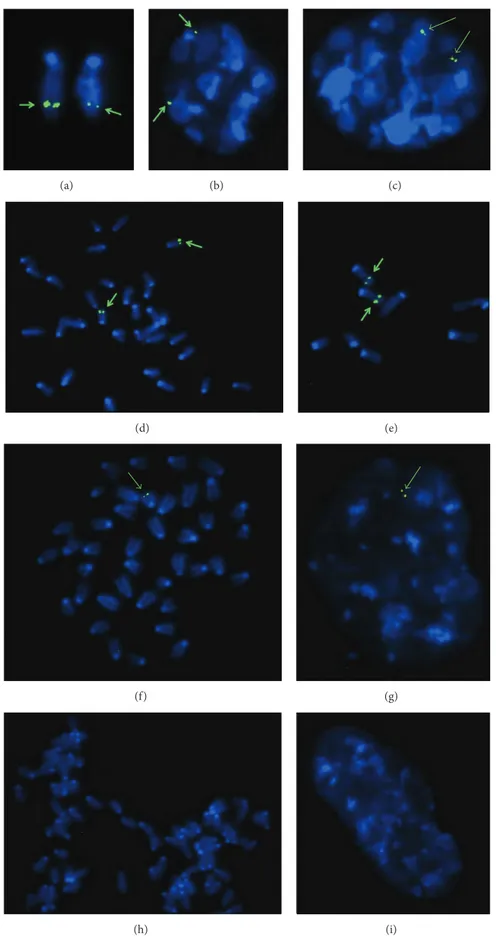 Figure 5: Fluorescence in situ hybridization results on metaphase (a, d, e, f, h) or G1 (b) and G2 (c, g, i) interphase nuclei of homozygous (a–e), hemizygous (f-g), and wild-type mice (h-i)