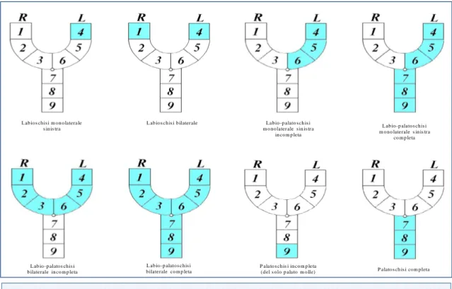 Figura 1.3.2: Rappresentazione delle principali forme di schisi nel diagramma di Kernahan