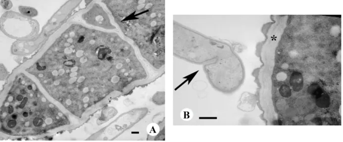 Figure 4. TEM of M. gypseum treated with 200 μg/mL α-bisabolol. (A) Septa are in closer 
