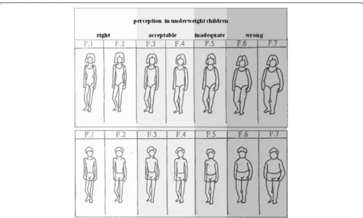 Figure 1 Evaluation of body image perception in underweight children using a Body Silhouette Chart (reproduced with kind permission of John Wiley &amp; Sons, Inc.) derived by Collins [18] according to the scheme: F.1/ correct; F.2/ correct; F.3/ acceptable