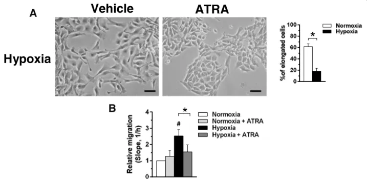 Fig. 5 Effects of ATRA on motility of MCF10DCIS cells. a Representative phase-contrast images of MCF10DCIS cells grown on plastic dishes under hypoxia for 96 h in the presence of 1 μM ATRA or DMSO (vehicle)